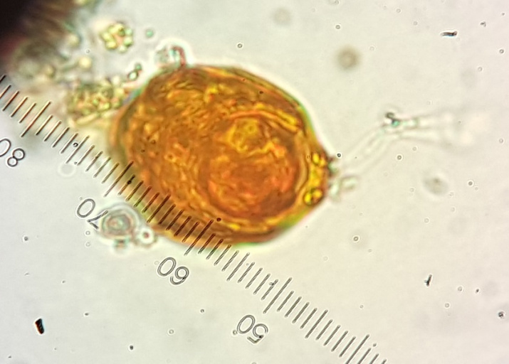 Chlamydomonas nivalis под микроскопом. Фото: Е. Макеева